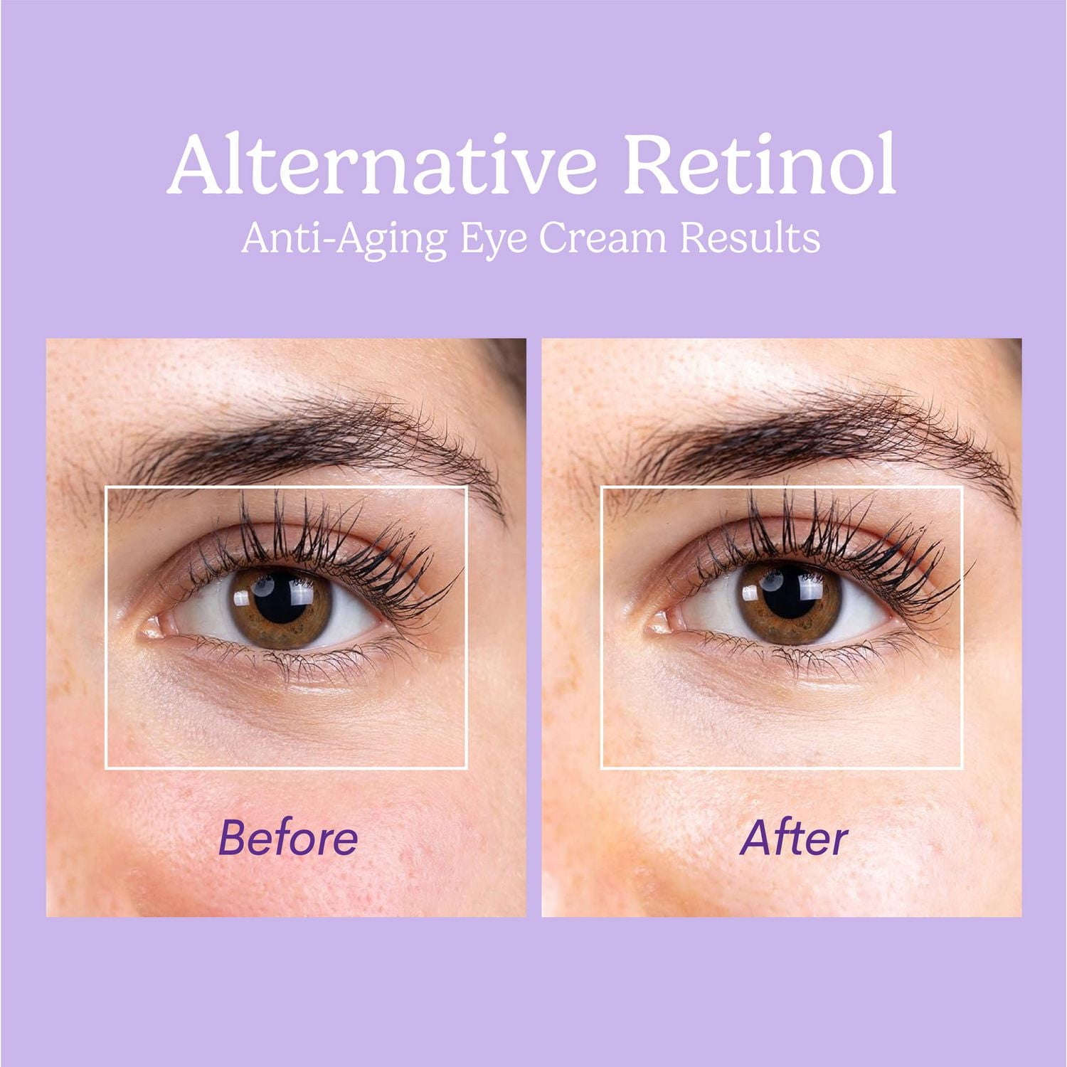 Excuse My Frank Bakuchiol Crème pour les yeux anti-âge Crème pour les yeux anti-âge