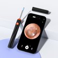 thumbnail image 3 of Royalbelle Electric Ear Wax Removal Tool Internal Lithium Battery 3MP Pixel Camera Silicone Ear Tip WiFi Connection With Gyroscope, 3 of 6