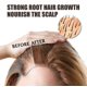 thumbnail image 4 of Scalp Hair Thickness Essence Hair Care Strengthening Hair Repair Repairing Roots Thick Hair Moistur, 4 of 4