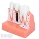 thumbnail image 4 of Modelo de dientes Análisis de implantes dentales Modelo de puente de corona Modelo de diente de demostración, 4 of 14