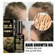 thumbnail image 1 of Spray anti-caída de Cabello Afortunado Sencillez Agente de Crecimiento del Cabello, 1 of 2