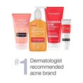 thumbnail image 3 of Neutrogena All-In-1 Acne Control Daily Face Scrub to Exfoliate & Treat Acne, with 2% Salicylic Acid Acne Medication, Exfoliating Acne Facial Scrub for Acne Marks & Breakouts, 4.2 fl. oz, Pack of 3, 3 of 3
