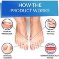 thumbnail image 2 of Ortesis Hallux Valgus de silicona modificada, 0% Bpa, talla única, separador de dedos, alisador, expansor ortopédico para protección, 2 of 3