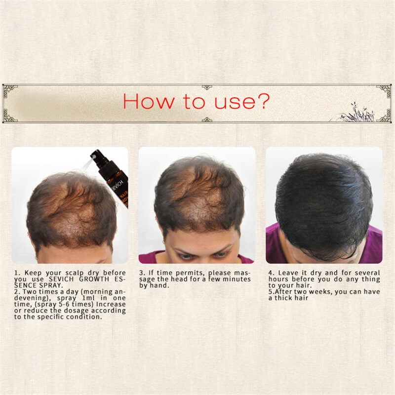100%Original] 30ml Hebal Essence Fast Hair Growth Hair Loss Treatment Help  for hair Growth Hair 