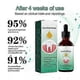thumbnail image 2 of 1-3x Gum Regrowth Drops, Natural Gum Restore Liquid Mouthwash, Gum Therapy Gel Receding Gum Repair Treatment, 2 of 5