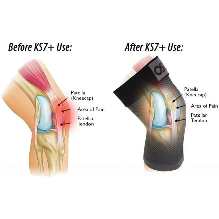 OrthoSleeve Adjustable KS7+ Performance Compression Knee Sleeve, Single,  XX-Large