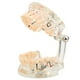 thumbnail image 4 of Modelo patológico de dientes dentales para adultos modelo de implante Dental modelo de enseñanza de dientes para estudio Dental ANGGREK Otros, 4 of 8