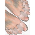 thumbnail image 1 of Yogamedic Silicone Toe Separators for Overlapping Toes, Bunion Relief and Alignment, 6-Pack, BPA-Free, One Size, Comfortable Stretching and Relaxation, 1 of 5