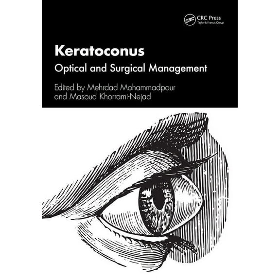 Keratoconus: Optical and Surgical Management, (Paperback)
