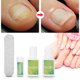 thumbnail image 3 of Juego De Herramientas De Pedicura Profesional Encarnadas, Recortador De Uñas De Los Pies, Fijador De Corrección De Uñas Encarnadas, Cuidado De Los Pies, 3 of 7