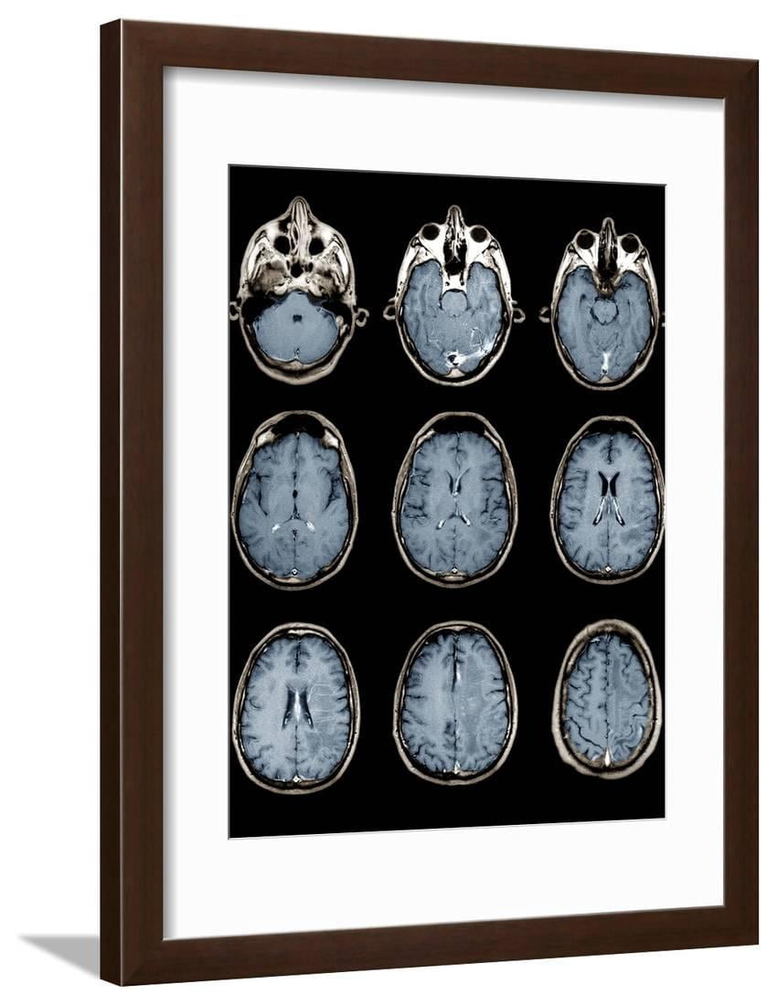 zephyr outdoor living center on Normal Brain Mri Scans Framed Print Wall Art By Zephyr Walmart Com Walmart Com