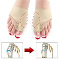 thumbnail image 2 of 1 par de separadores de dedos del pie Hallux Valgus Corrector de juanetes martillo alisador de dedos del pie alivio del dolor en el pie herramientas de pedicura ortopédica cuidado de los pies Tan Jianjun unisex, 2 of 2