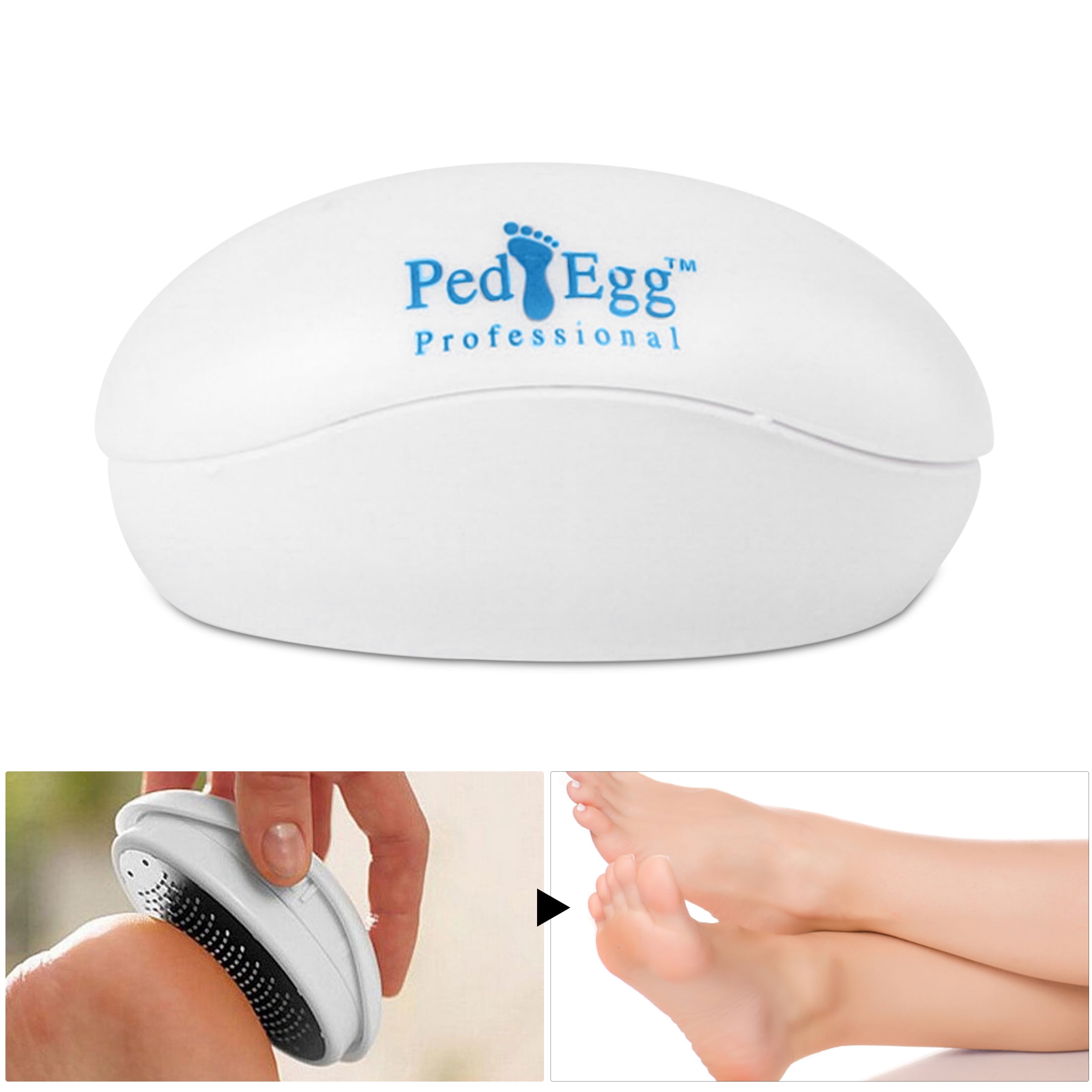 ped egg for calluses