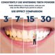 thumbnail image 4 of Teeth Whitening Powder, Whitening Colour Corrector, Purple Corrector Powder For Against Yellow Teeth White Teeth Fresh Breath, 4 of 5