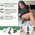 thumbnail image 3 of Cellulite Relief Kit, 12-Level Suction & 3-Speed Heating Cellulite Massager with Red Light, 3 of 7