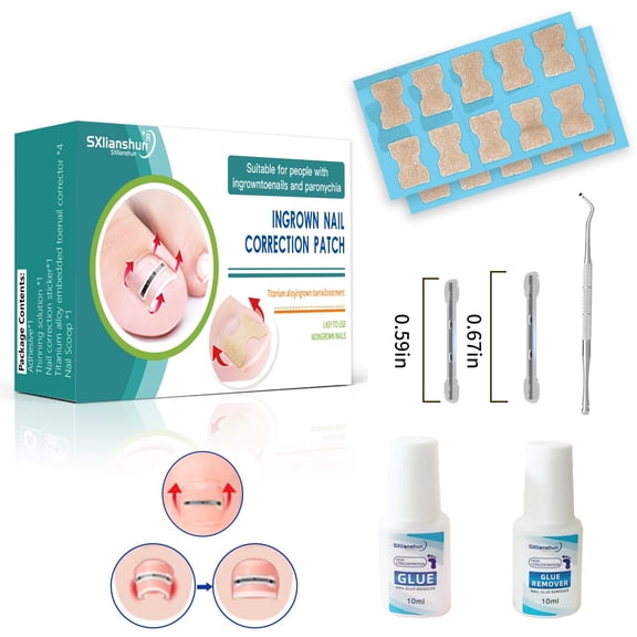 Ingrown Toenail Corrector, Toenail Splint Dual Nitinol Ingrown Nail Treatment Corrector for Big Toe Ingrown Nail Treatment