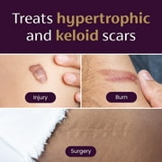 Mederma Medical Grade Small Silicone Scar Sheets; Improves the Appearance of Old and New Scars; for Injury, Burn and Surgery Scars, 4 Count