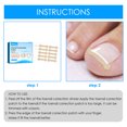 thumbnail image 1 of Parches De Corrección De Uñas Pegatinas de corrección de uñas Corrector de uñas encarnadas Parches Tratamiento de uñas Ndcxsfigh Cuidado Belleza, 1 of 8
