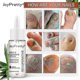thumbnail image 4 of 1/2/3 Uds líquido de onicomicosis cóncavo y convexo áspero punto de uñas onicomicosis suave reparación de uñas Liqu, 4 of 5