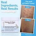 thumbnail image 4 of Dry Skin Soothing Cream with Colloidal Oatmeal & Chamomile – Moisturizing Lotion for Sensitive, Irritated Skin, 4 of 6