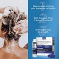 thumbnail image 3 of Anti Dandruff Shampoo for Men & Women, 3 of 5