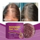 thumbnail image 4 of Fiudx Jabón de Jengibre, Fórmula Nutritiva con Ingredientes Naturales, Limpieza Profunda Del Cuero Cabelludo, Control de Grasa para Prevenir La Caída Del Cabello, Apto para Viajes, Ideal para Amantes, 4 of 6