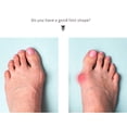 thumbnail image 4 of MERIGLARE 10 Packs Soft Reusable Sleeves Pinky Toe Separator Little Toe Straightener, Easy Skin Color, 4 of 6