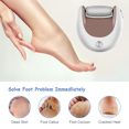 thumbnail image 4 of Lima para pies removedor de callos de maíz, exfoliante electrónico portátil para piel muerta, herramientas de suministros de pedicura, 4 of 5