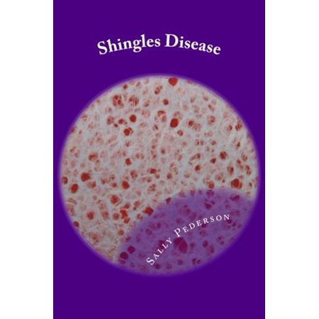 Shingles Disease: The Complete Guide - eBook