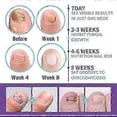 thumbnail image 5 of 1/2/3Pcs Medinail Fungus Spray,Toenail Fungus Treatment,Nail Fungus Treatment For Toenail, 5 of 5