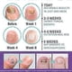 thumbnail image 5 of 1/2/3Pcs Medinail Fungus Spray,Toenail Fungus Treatment,Nail Fungus Treatment For Toenail, 5 of 5