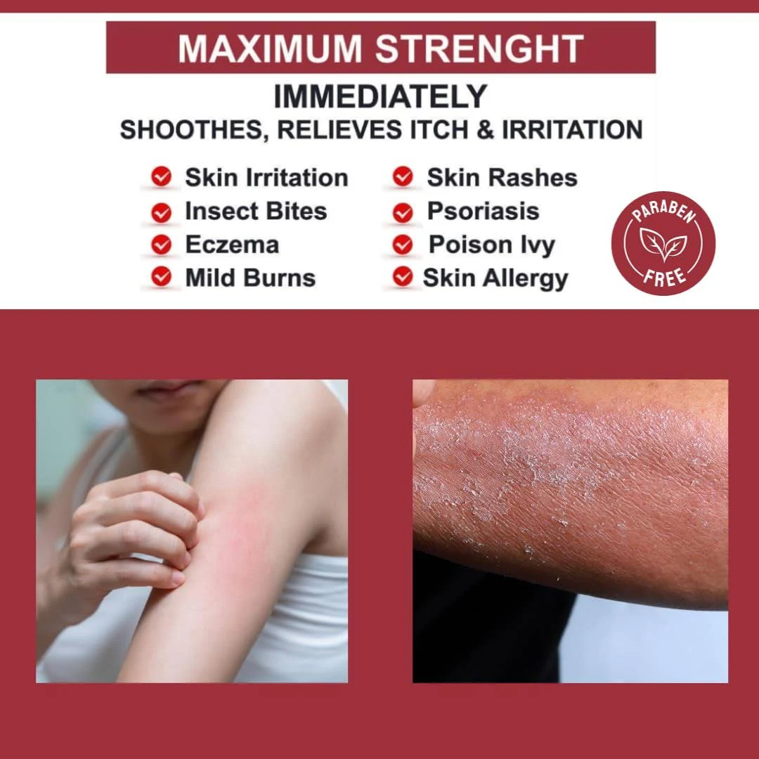 Quatriderm Ointment 2oz – Skin Relief Cream for Redness, Dryness, and Irritated Skin-Unisex Cream