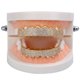 thumbnail image 4 of Crystal AAA Zircon 8 dientes superiores y 8 dientes inferiores Hip Hop Boca Grill - Oro Jinwen Tapas de boca y dientes, 4 of 8