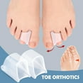 thumbnail image 3 of Hammer Toe Straightener Corrector for Overlapping Curled Toes Bunions Crooked, 3 of 9