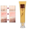 thumbnail image 3 of Gel Para Eliminar Cicatrices Gel Para Reparar La Piel Gel Anticicatrices Tratamiento De Estrías Pomada Para Eliminar Cicatrices 30g Gel Para Eliminar Cicatrices De Marcas De Acné ANGGREK Otros, 3 of 8
