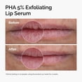 thumbnail image 4 of Dúo para Cuidado de Labios The Ordinary PHA 5% Sérum Exfoliante + Bálsamo, 4 of 7