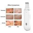 thumbnail image 4 of Limpiador facial HUOGUO Depurador ultrasónico de piel blanco, 4 of 5