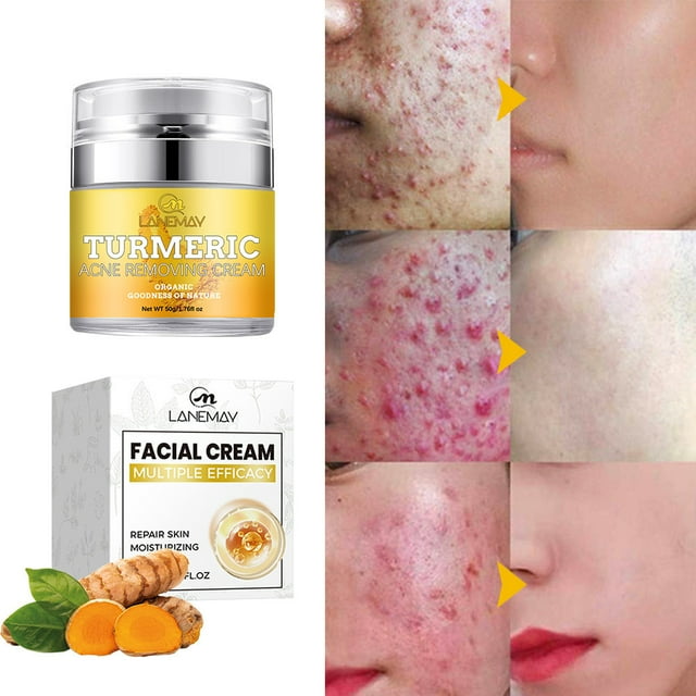 Xihbxyly Ofertas de venta de Lightling Crema facial, rostro y cuerpo - Loción iluminada de piel y cúrcuma natural - La cúrcuma limpia la piel, combate y unifica el tono, el daño solar