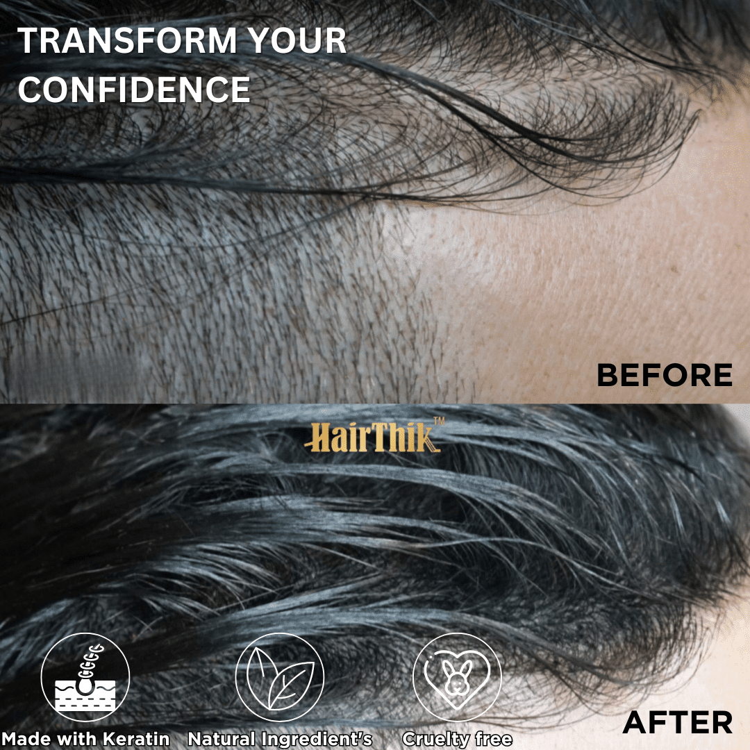 HairThik Hair Building Fibers - Instantly Fill in Fine or Thinning Hair for Thicker, Fuller-Looking Hair for Men & Women – Hair Thinning & Balding solution | BLACK, 25 Grams - HFR/25B