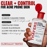 THAYERS Blemish Clearing Salicylic Acid Toner, Acne Treatment Face Toner with 2% Salicylic Acid, Soothing and Non-Stripping Skin Care 12.0 fl. oz.