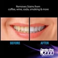 thumbnail image 3 of DentaPro 2000 3D Teeth Whitening Kit  Deluxe Addition Includes LED Light, 2 5ml Gel Syringes, Custom Moldable Tray 2, Vitamin E Swab 2, Shade Guide  See Results After Just One Use!, 3 of 8