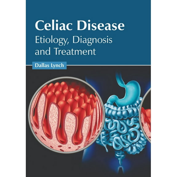 Celiac Disease: Etiology, Diagnosis and Treatment, (Hardcover)