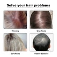 thumbnail image 3 of Hoegoa Hairline Powder Complementary Color Filling Hairline Top Cover Refreshing Fluffy Sculpting Contour Powder, 3 of 5