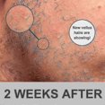 thumbnail image 4 of Beard Growth Kit, Beard Derma Roller 0.3mm, Beard Oil For Facial Hair Growth For Men And Dads, Grooming Tool, 4 of 5