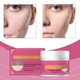thumbnail image 4 of Kokovifyves Salicylic Cream Blackhead Remover Reduces Pigmentation Restores Skin To Smoothness 50g, 4 of 9