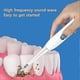 thumbnail image 2 of Tooth Grinder, Dental Electric Small Grinder, Polishing And Repairing Teeth, Cleaning And Removing Calculus, 2 of 2