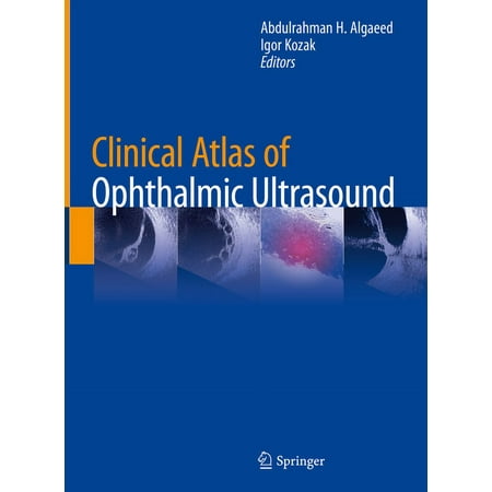UPC: 9783319998695 | Clinical Atlas of Ophthalmic Ultrasound (Hardcover)
