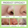 thumbnail image 4 of Blackhead Remover Pore Strips, Black Head Remover for Face, Natural Bamboo Charcoal Nose Strips for Pore Cleaner,Oil Blackheads &, 4 of 5