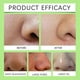 thumbnail image 4 of Blackhead Remover Pore Strips, Black Head Remover for Face, Natural Bamboo Charcoal Nose Strips for Pore Cleaner,Oil Blackheads &, 4 of 5