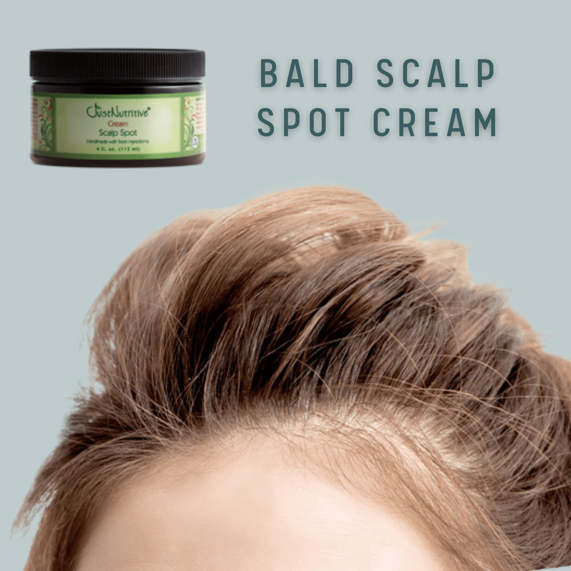 Bald Scalp Spot Cream / Bald Spot Treatment 